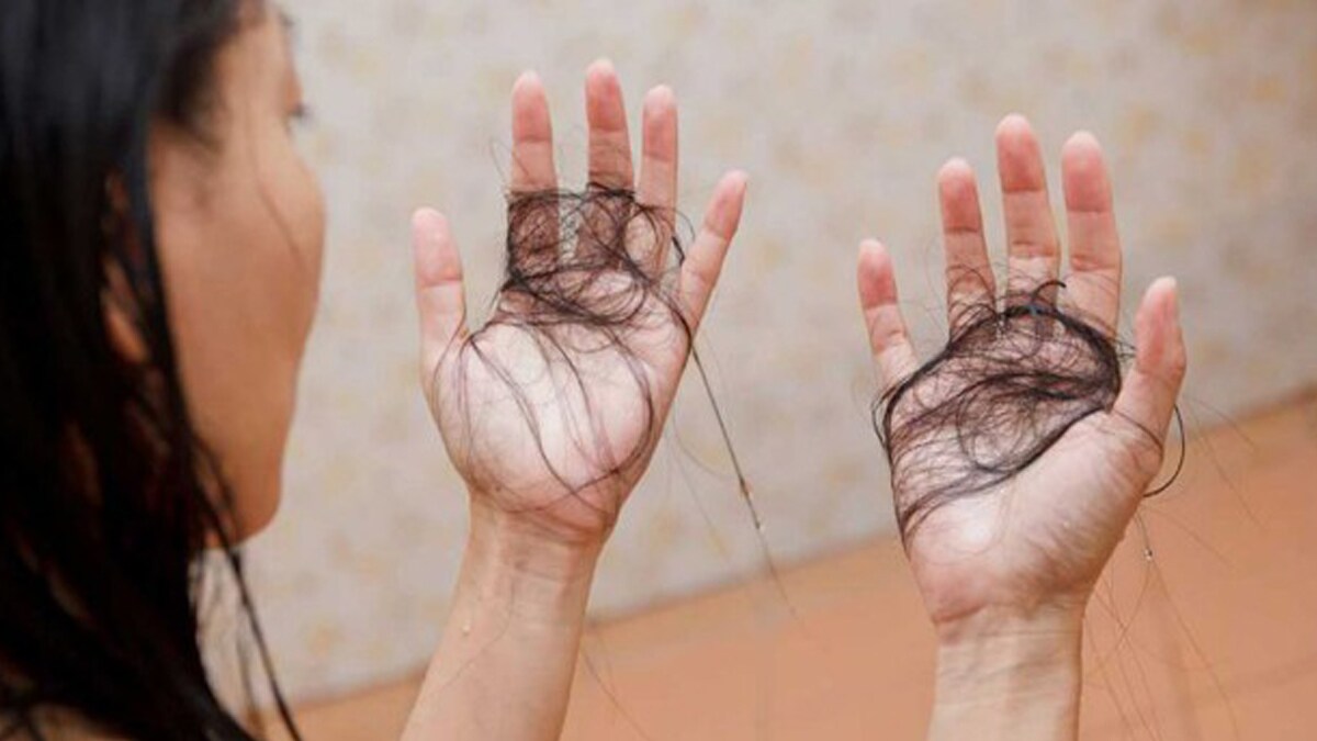 Hairloss-jpeg