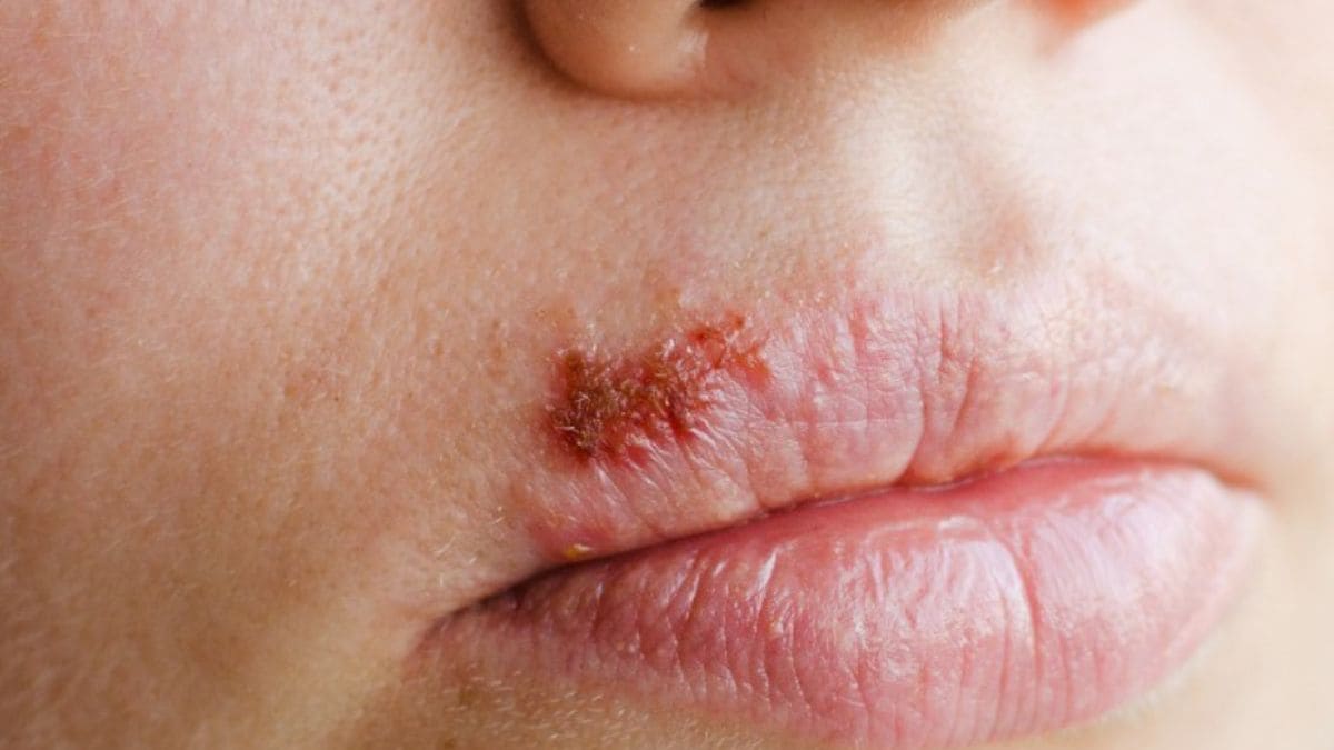 lips - 1