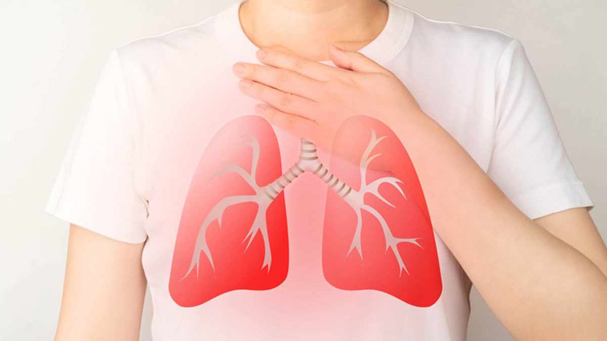 tb-tuberculosis-new