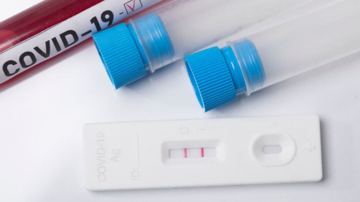 Covid-19 resurgence: 40-year-old dies of coronavirus in Chandigarh