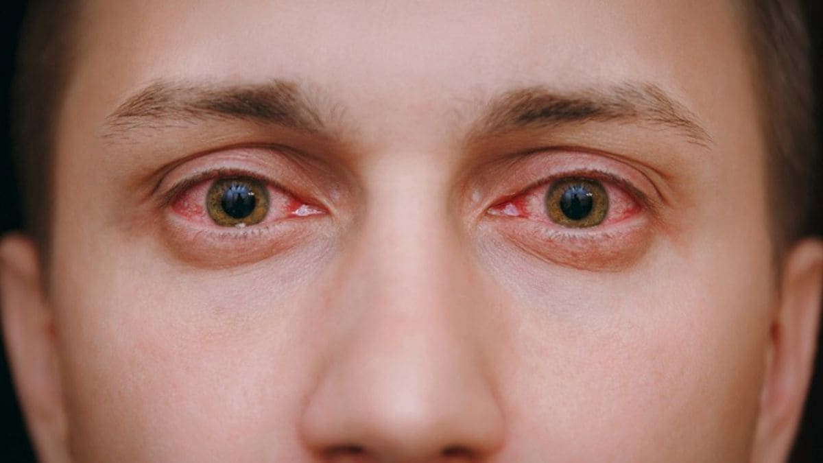 Health-Eye-care - 1