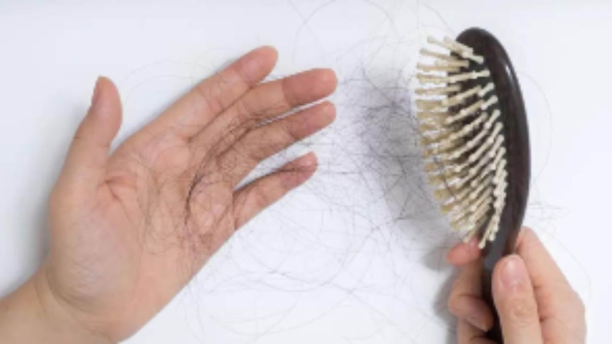 health-hairloss - 1