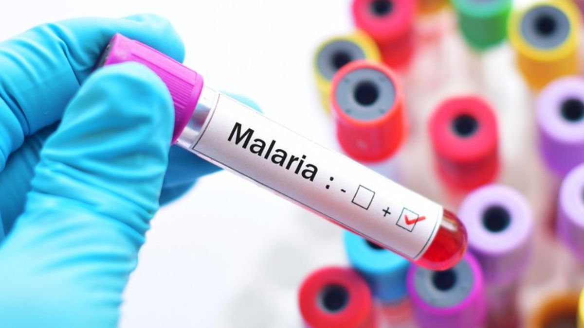 Malaria - 1