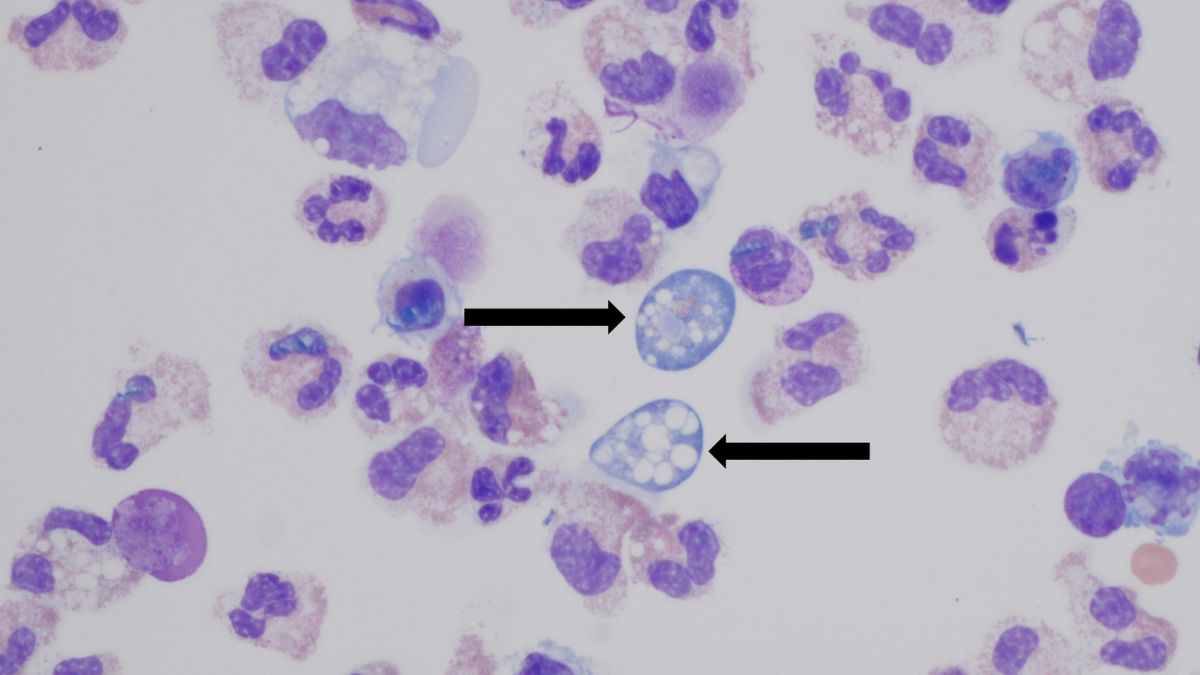 Naegleria fowleri - 1