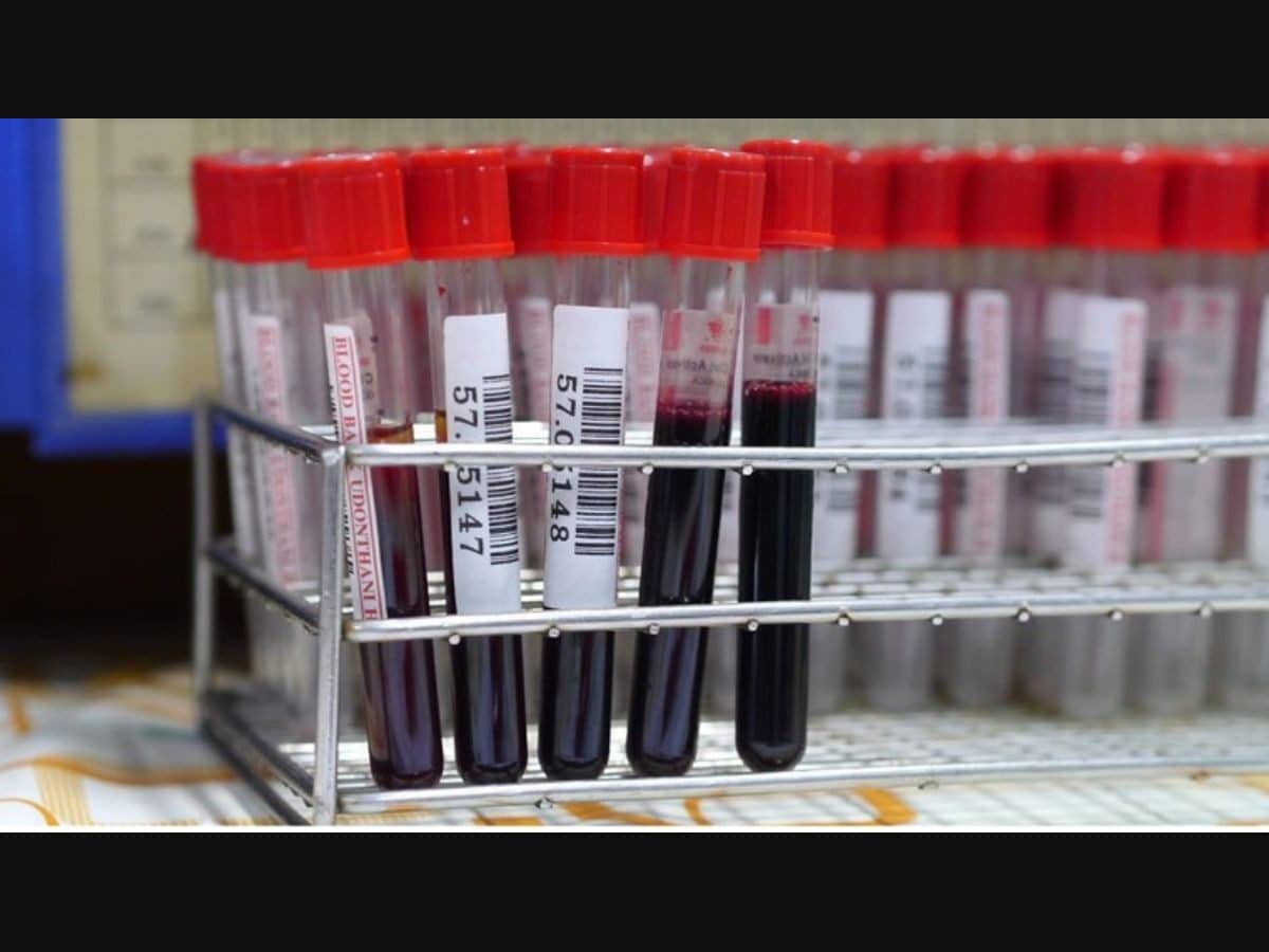 Could a simple blood test spot Alzheimer’s early? What you need to know