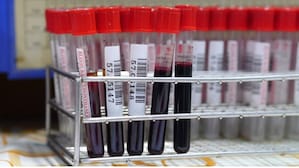 Health tests you should not ignore after 30: From blood sugar to cancer screening