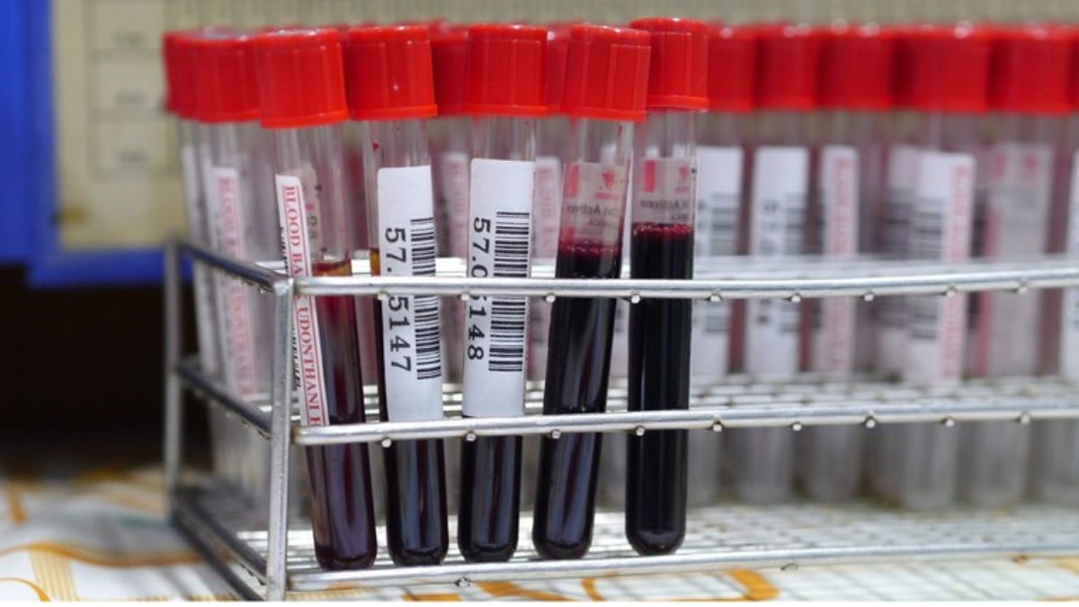 health-blood-test - 1