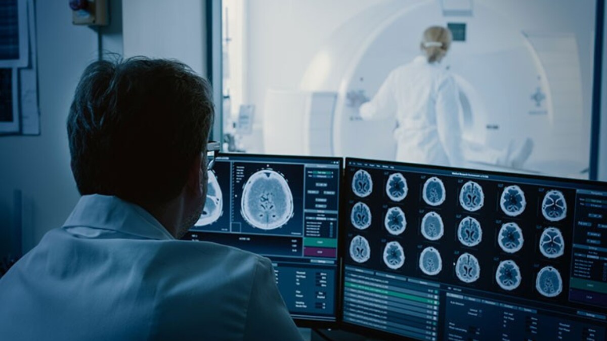 health-stroke - 1