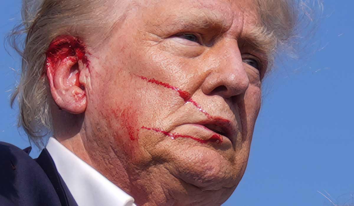 Republican presidential candidate, former U.S. President Donald Trump is seen bleeding from his ears after an assassination attempt on him during a rally in Pennsylvania | AFP